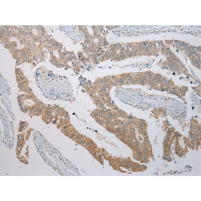 Immunohistochemistry - ITLN2 Antibody from Signalway Antibody (42927) - Antibodies.com