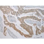 Immunohistochemistry - ITLN2 Antibody from Signalway Antibody (42927) - Antibodies.com