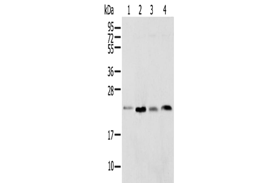 SPCS2 Antibody from Signalway Antibody (42942) - Antibodies.com