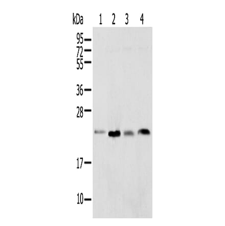SPCS2 Antibody from Signalway Antibody (42942) - Antibodies.com