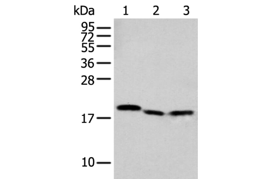 NUDT2 Antibody from Signalway Antibody (42947) - Antibodies.com
