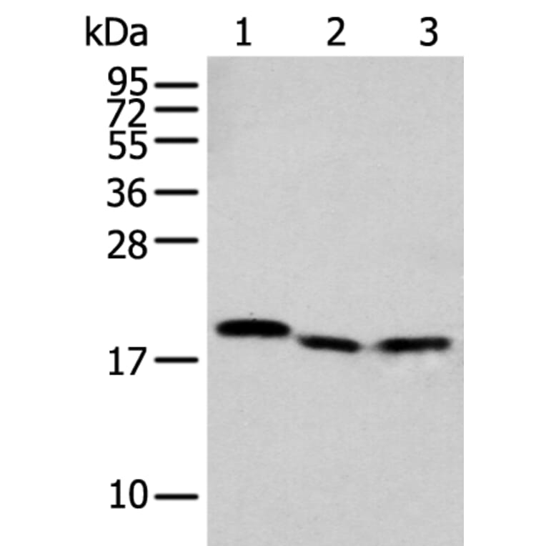 NUDT2 Antibody from Signalway Antibody (42947) - Antibodies.com