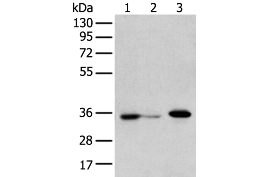 DHRSX Antibody from Signalway Antibody (42957) - Antibodies.com