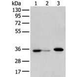 DHRSX Antibody from Signalway Antibody (42957) - Antibodies.com