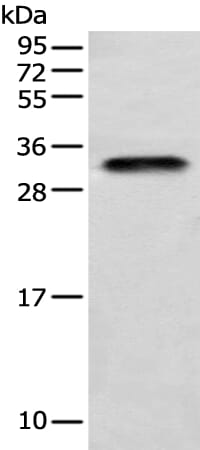 Gel: 12% SDS-PAGE Lysate: 40 &#956;g Lane: Human testis tissue Primary antibody: 1/400 dilution Secondary antibody: Goat anti rabbit IgG at 1/8000 dilution Exposure time: 1 minute