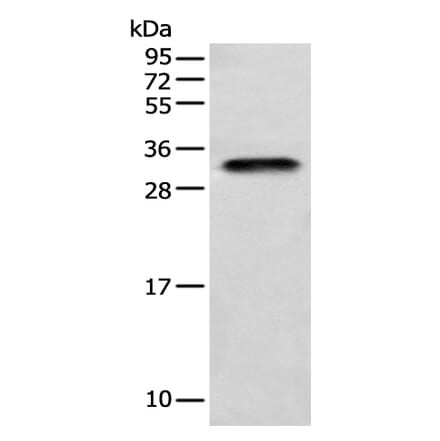 LYPD4 Antibody from Signalway Antibody (42972) - Antibodies.com
