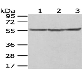 PTBP1 Antibody from Signalway Antibody (43006) - Antibodies.com