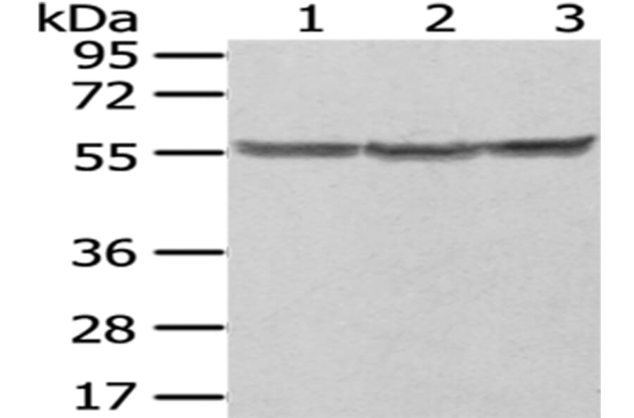 PTBP1 Antibody from Signalway Antibody (43006) - Antibodies.com