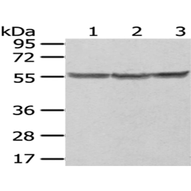 PTBP1 Antibody from Signalway Antibody (43006) - Antibodies.com