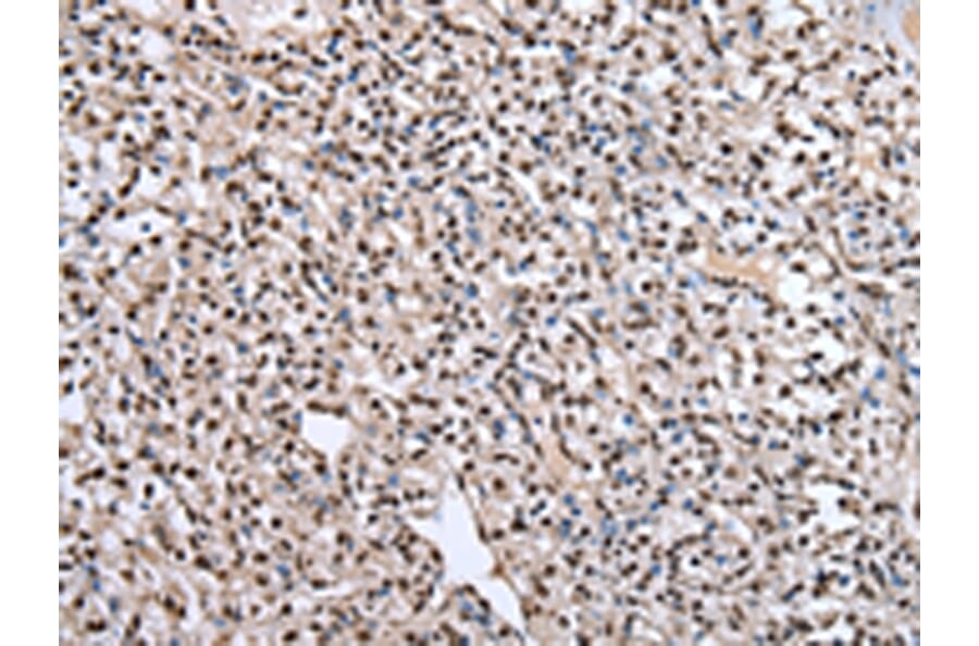 Immunohistochemistry - PTBP1 Antibody from Signalway Antibody (43006) - Antibodies.com