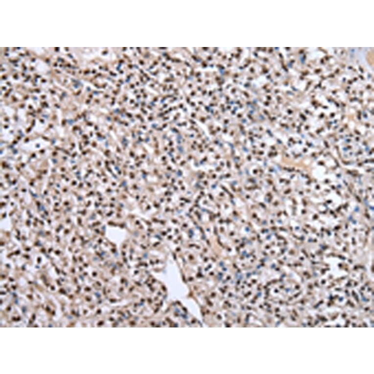 Immunohistochemistry - PTBP1 Antibody from Signalway Antibody (43006) - Antibodies.com