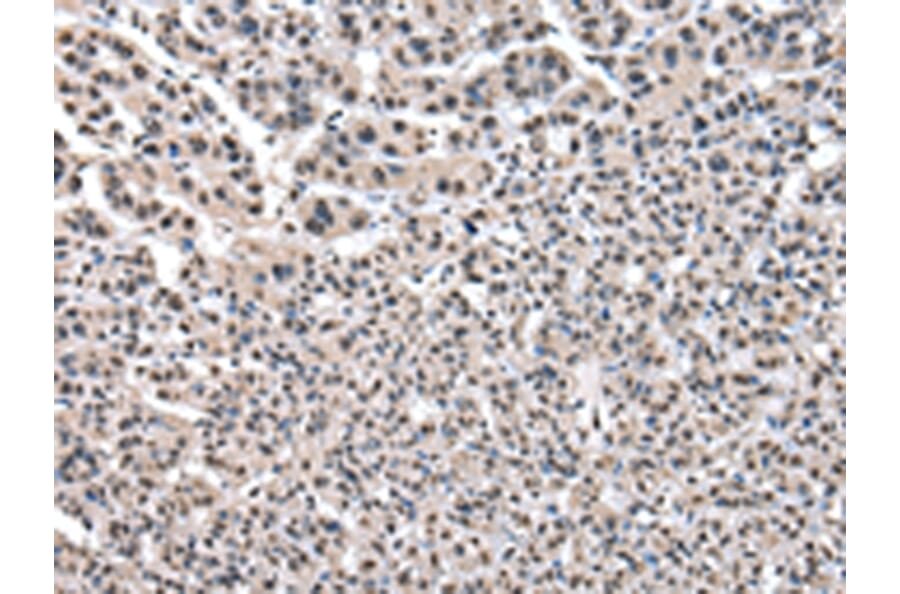 Immunohistochemistry - PTBP1 Antibody from Signalway Antibody (43006) - Antibodies.com