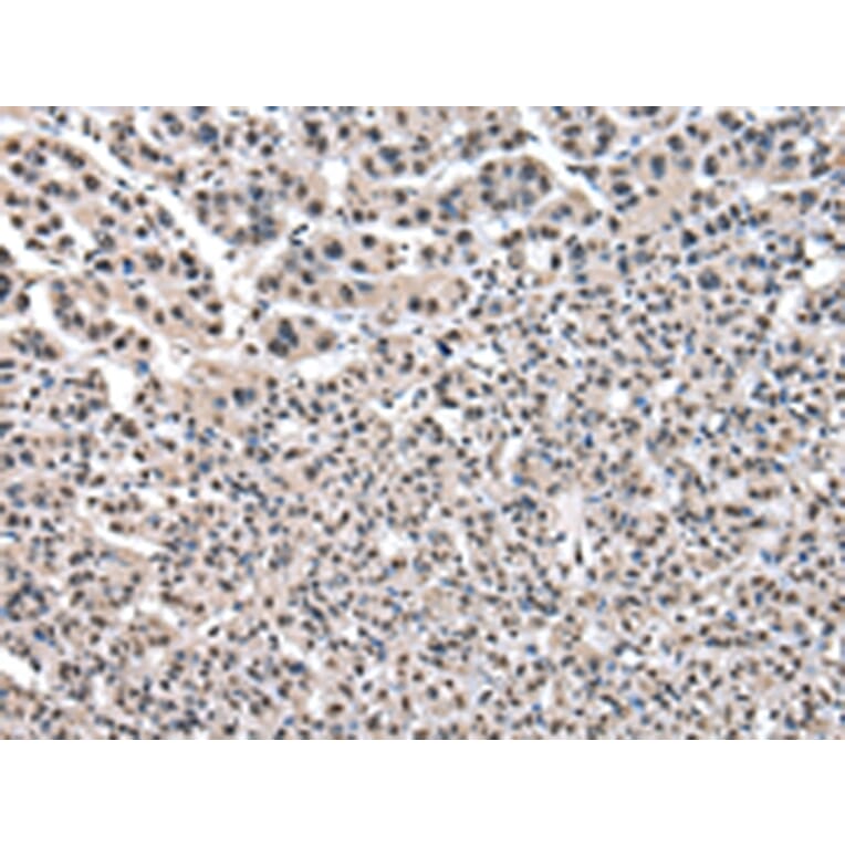 Immunohistochemistry - PTBP1 Antibody from Signalway Antibody (43006) - Antibodies.com