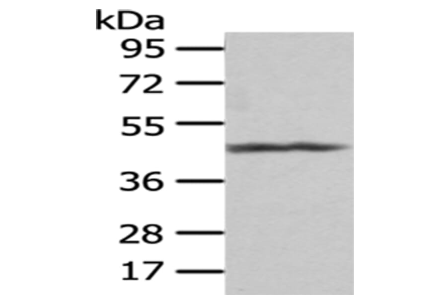 PTGIR Antibody from Signalway Antibody (43008) - Antibodies.com