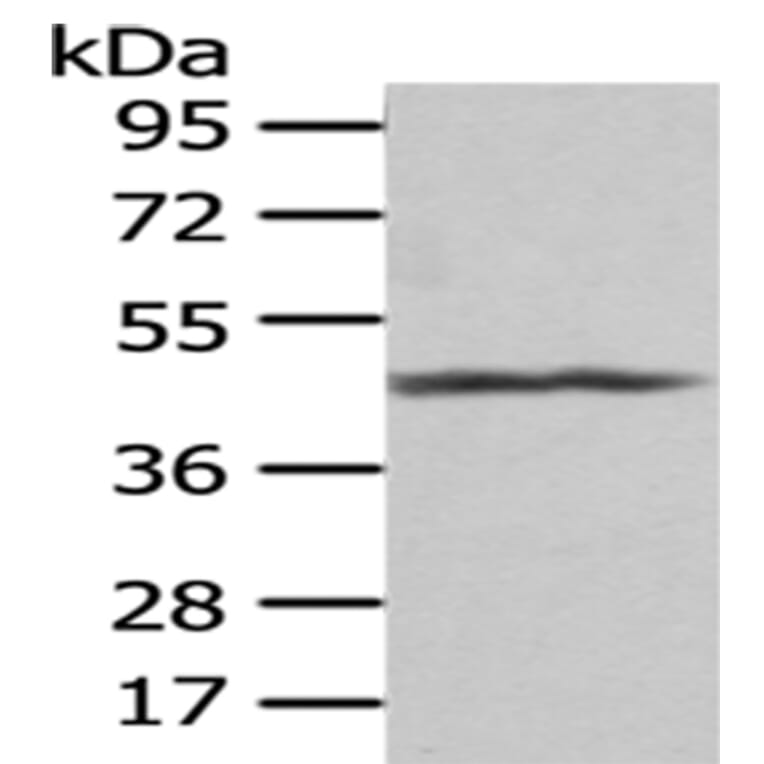 PTGIR Antibody from Signalway Antibody (43008) - Antibodies.com