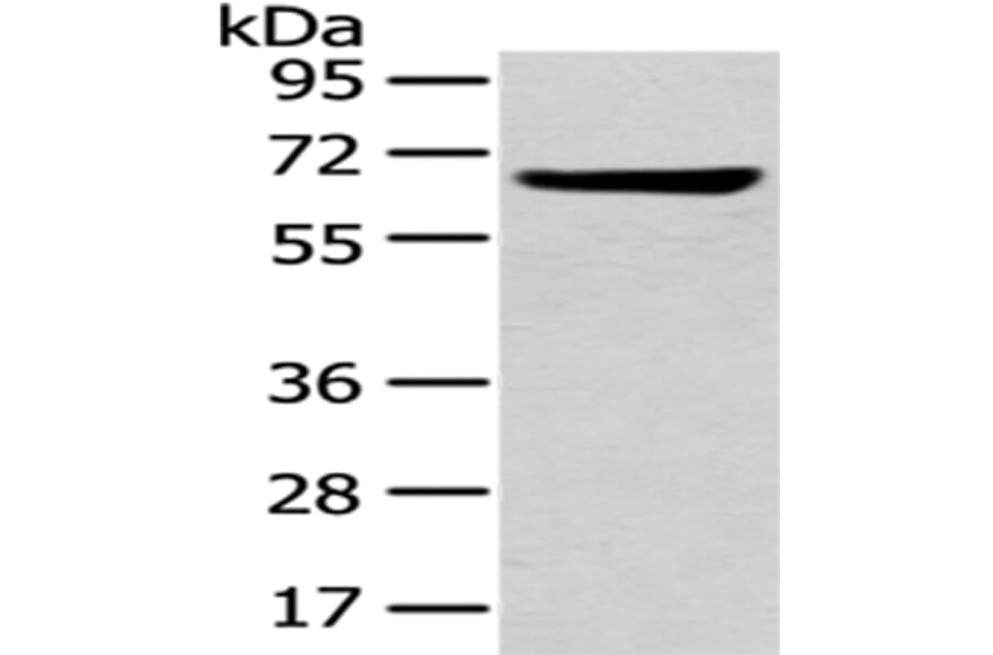 U2AF2 Antibody from Signalway Antibody (43012) - Antibodies.com