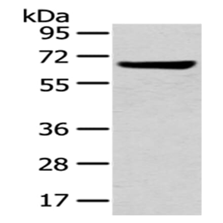 U2AF2 Antibody from Signalway Antibody (43012) - Antibodies.com