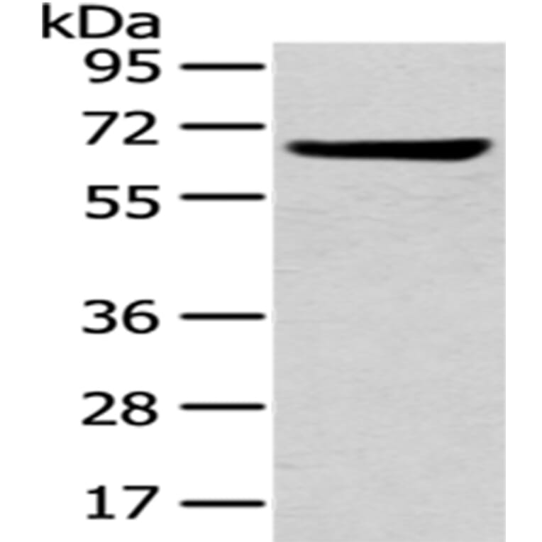 U2AF2 Antibody from Signalway Antibody (43012) - Antibodies.com