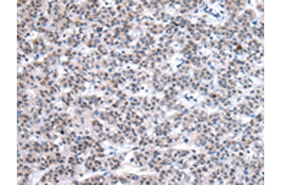 Immunohistochemistry - U2AF2 Antibody from Signalway Antibody (43012) - Antibodies.com