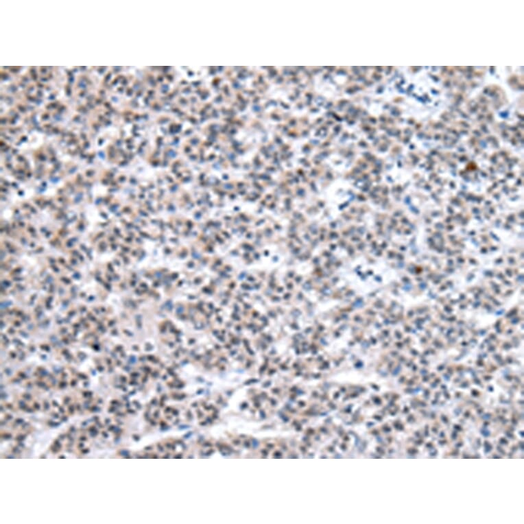 Immunohistochemistry - U2AF2 Antibody from Signalway Antibody (43012) - Antibodies.com