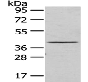 TOR1A Antibody from Signalway Antibody (43017) - Antibodies.com