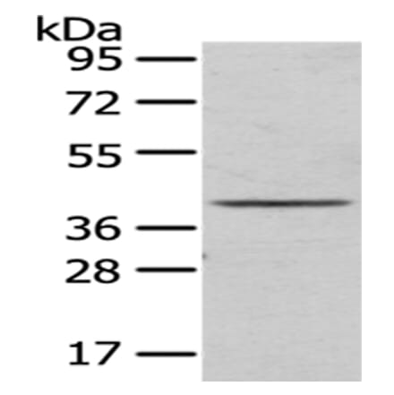 TOR1A Antibody from Signalway Antibody (43017) - Antibodies.com