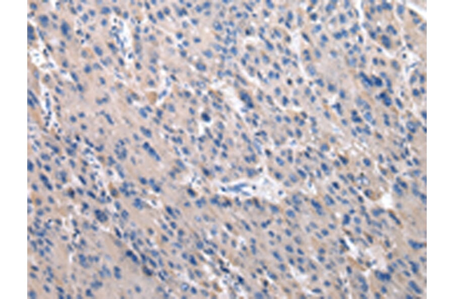 Immunohistochemistry - TOR1A Antibody from Signalway Antibody (43017) - Antibodies.com