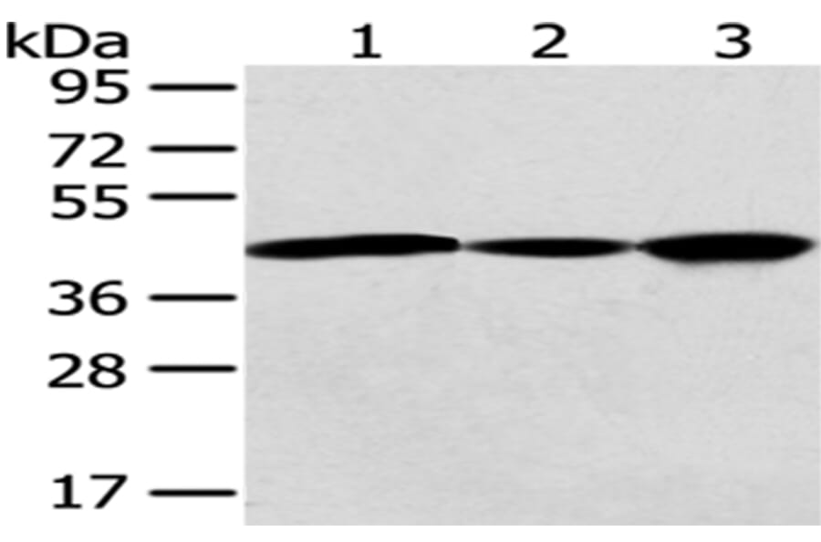 GNAO1 Antibody from Signalway Antibody (43020) - Antibodies.com