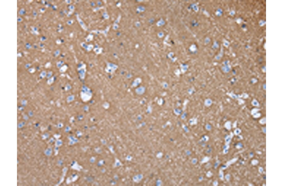 Immunohistochemistry - GNAO1 Antibody from Signalway Antibody (43020) - Antibodies.com