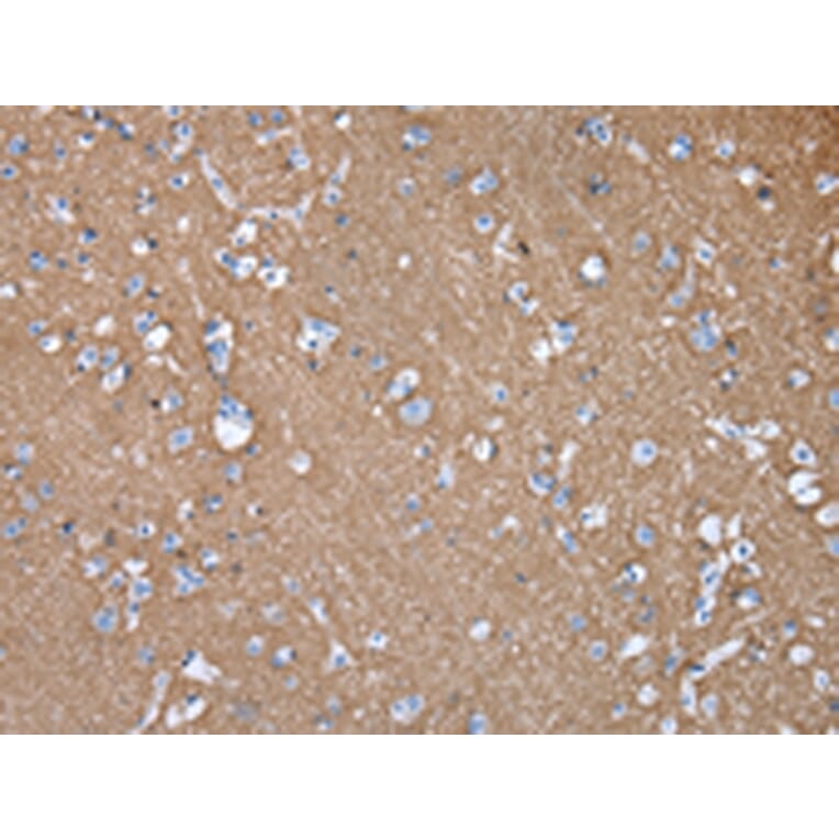 Immunohistochemistry - GNAO1 Antibody from Signalway Antibody (43020) - Antibodies.com