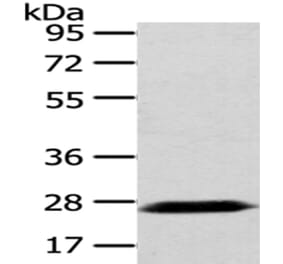 PDZK1 Antibody from Signalway Antibody (43025) - Antibodies.com
