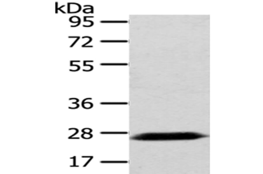 PDZK1 Antibody from Signalway Antibody (43025) - Antibodies.com