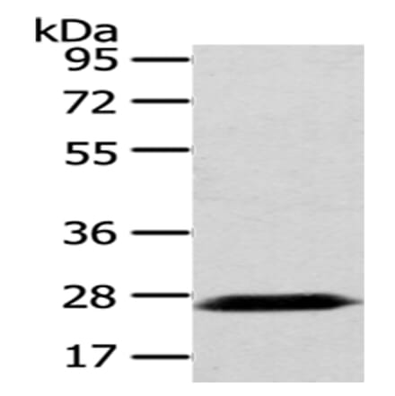 PDZK1 Antibody from Signalway Antibody (43025) - Antibodies.com