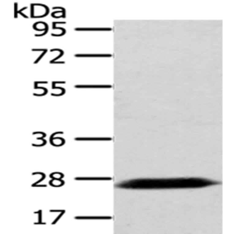PDZK1 Antibody from Signalway Antibody (43025) - Antibodies.com