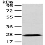 PDZK1 Antibody from Signalway Antibody (43025) - Antibodies.com