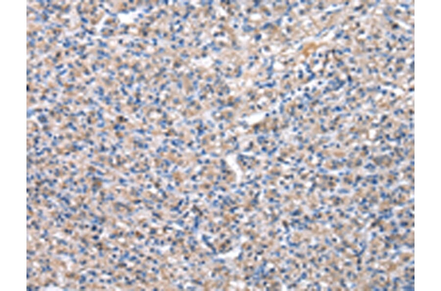 Immunohistochemistry - PDZK1 Antibody from Signalway Antibody (43025) - Antibodies.com