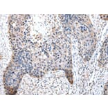 Immunohistochemistry - PDZK1 Antibody from Signalway Antibody (43025) - Antibodies.com