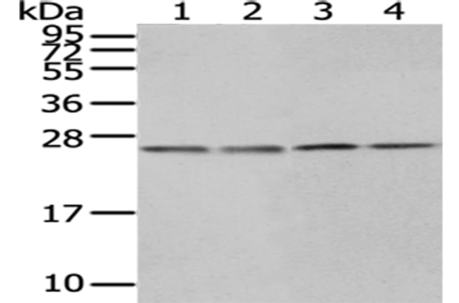 HPRT1 Antibody from Signalway Antibody (43033) - Antibodies.com