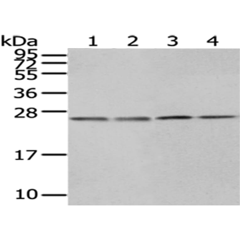 HPRT1 Antibody from Signalway Antibody (43033) - Antibodies.com