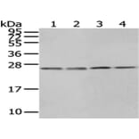 HPRT1 Antibody from Signalway Antibody (43033) - Antibodies.com