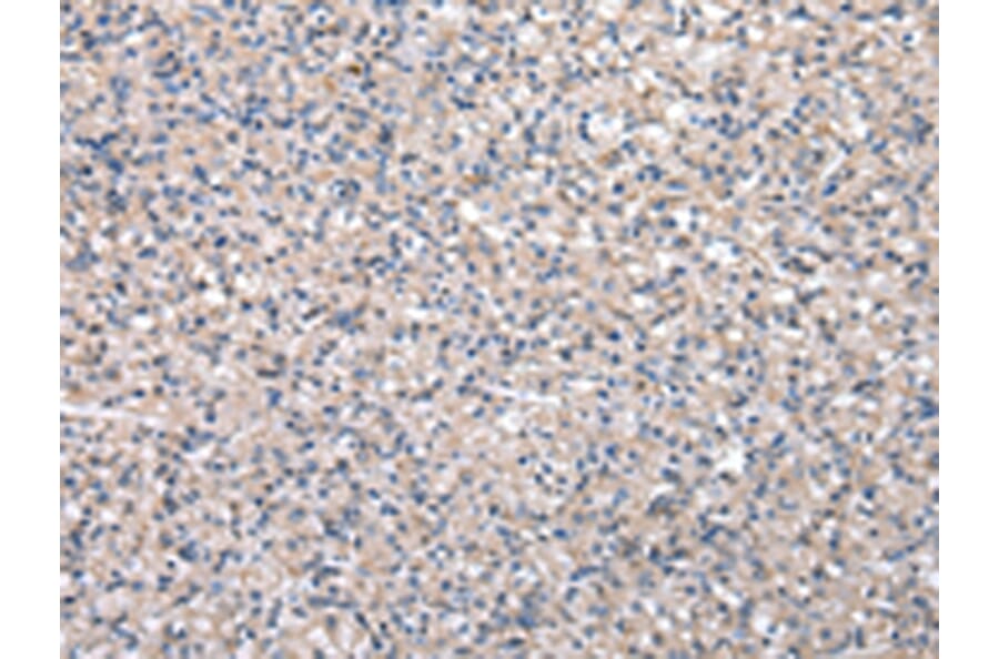 Immunohistochemistry - HPRT1 Antibody from Signalway Antibody (43033) - Antibodies.com