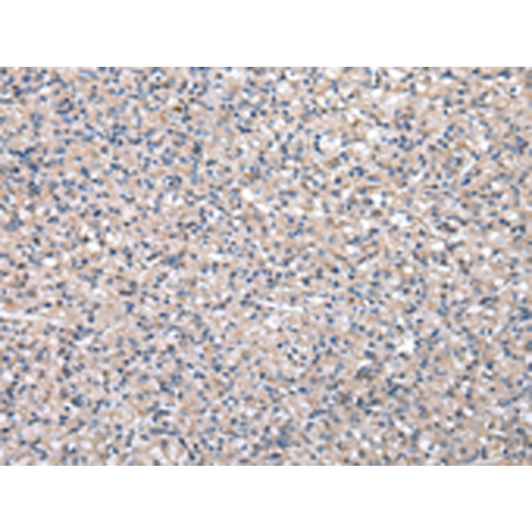 Immunohistochemistry - HPRT1 Antibody from Signalway Antibody (43033) - Antibodies.com