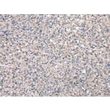 Immunohistochemistry - HPRT1 Antibody from Signalway Antibody (43033) - Antibodies.com