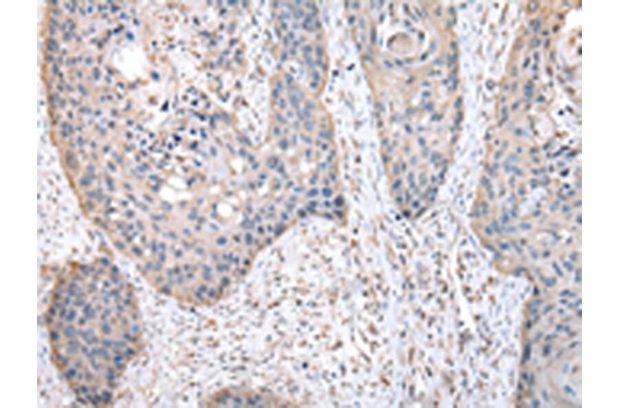 Immunohistochemistry - HPRT1 Antibody from Signalway Antibody (43033) - Antibodies.com