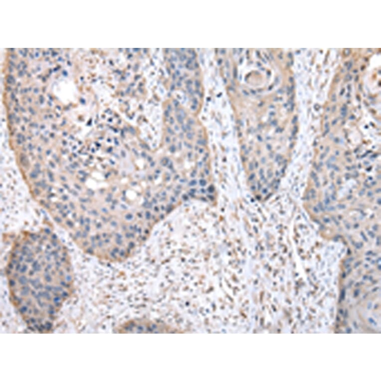 Immunohistochemistry - HPRT1 Antibody from Signalway Antibody (43033) - Antibodies.com