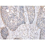 Immunohistochemistry - HPRT1 Antibody from Signalway Antibody (43033) - Antibodies.com