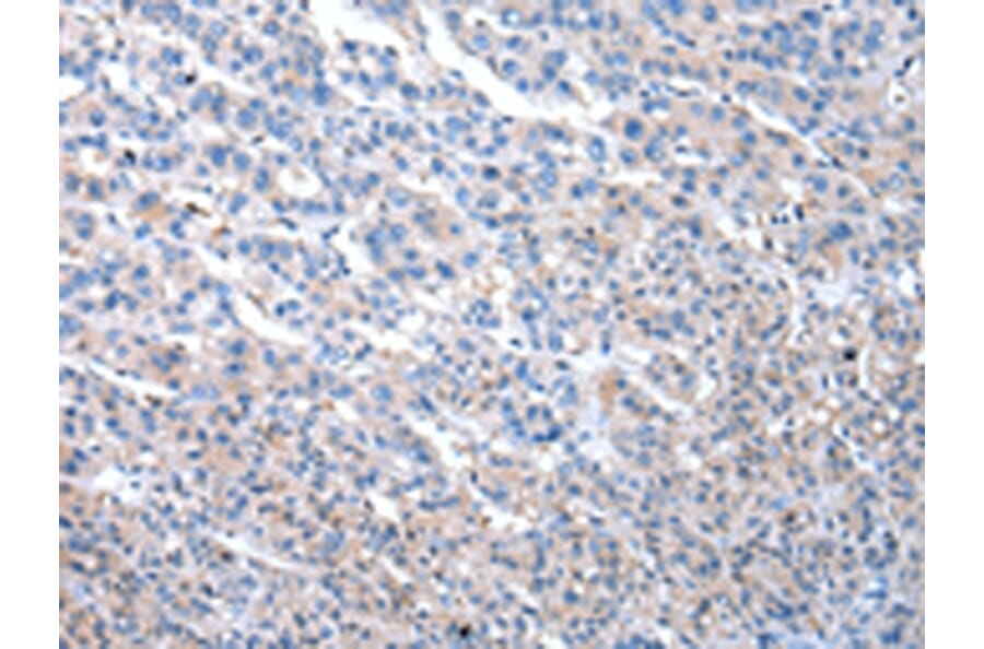 Immunohistochemistry - MASP1 Antibody from Signalway Antibody (43034) - Antibodies.com