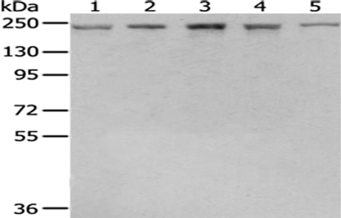 Gel: 6%SDS-PAGE Lysate: 40 &#956;g Lane 1-5: NIH/3T3, hepg2, hela, 231 and Raji cell Primary antibody: 1/400 dilution Secondary antibody: Goat anti rabbit IgG at 1/8000 dilution Exposure time: 10 seconds