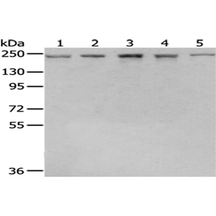 BTAF1 Antibody from Signalway Antibody (43040) - Antibodies.com