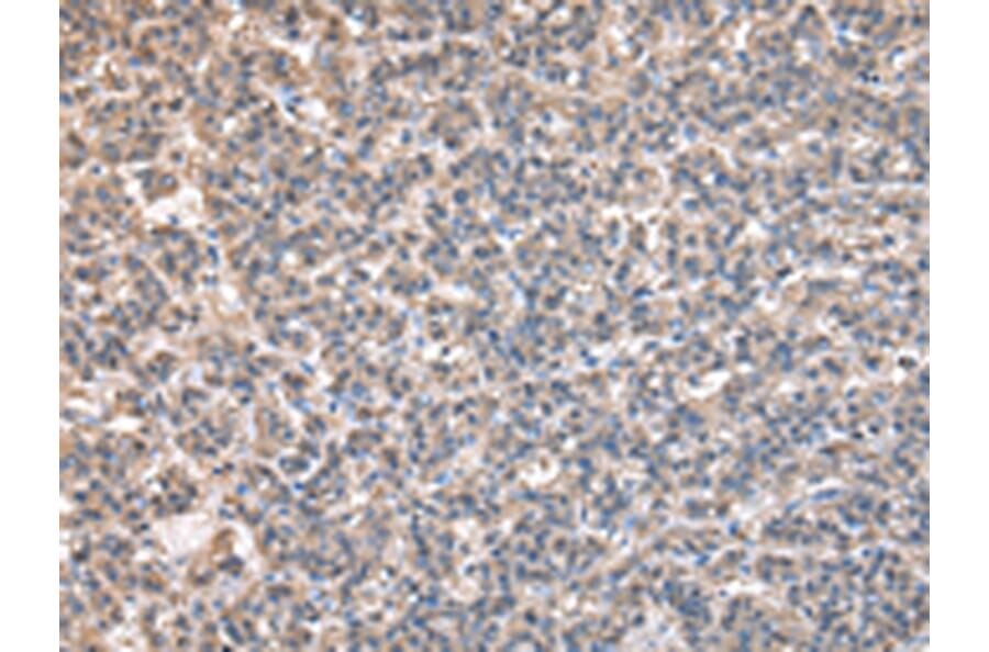 Immunohistochemistry - BTAF1 Antibody from Signalway Antibody (43040) - Antibodies.com